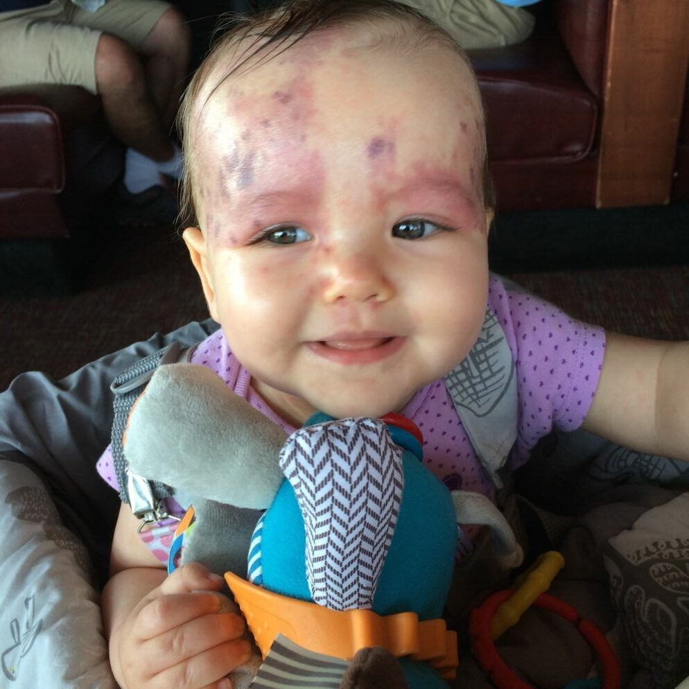 Kennedy Krieger Study Helps Prevent Infant Seizures